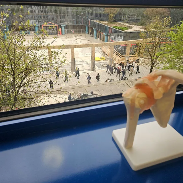 Sicht aus Fenster, künstliches Gelenk